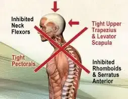 Posture Assessment treatment